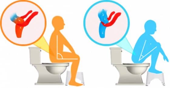 Forføre Trække ud stakåndet Bad Pooping Posture Leads to Constipation - What To Do